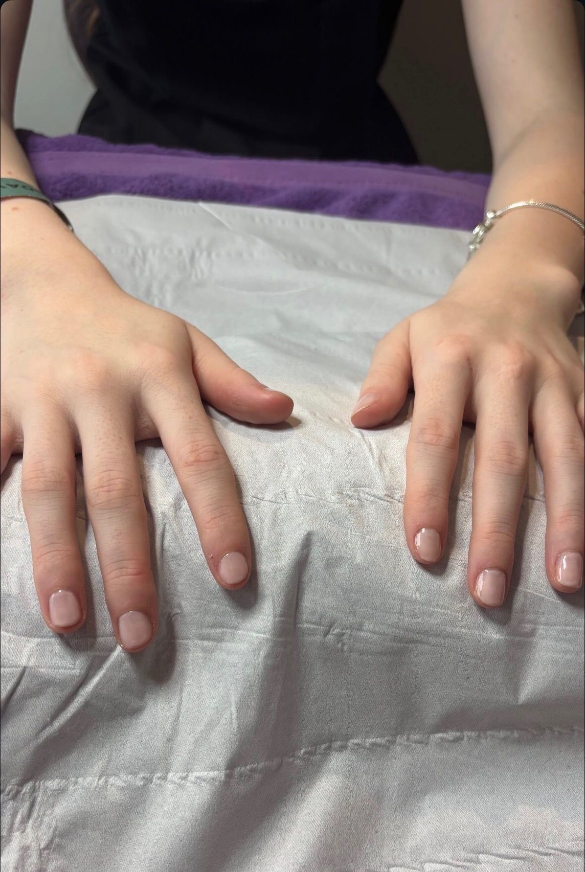 Short natural nails